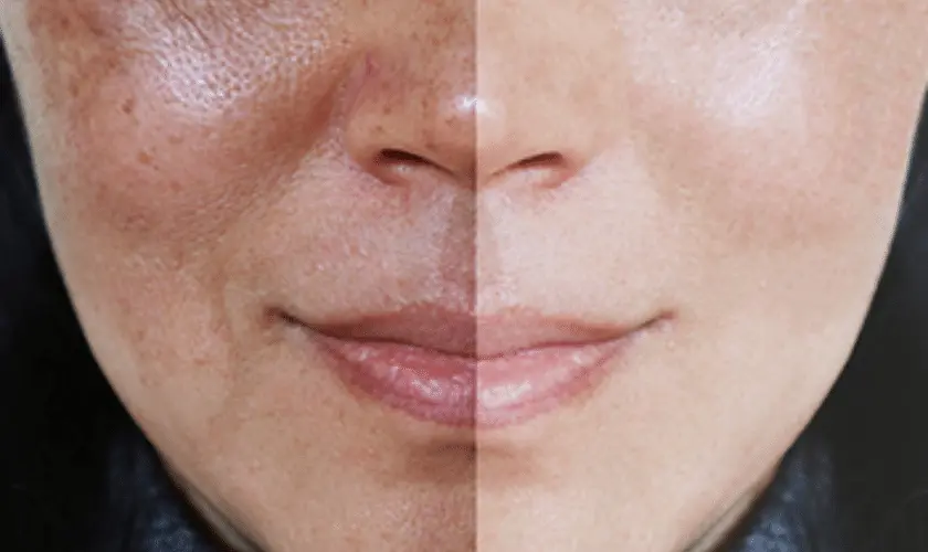 What Lifestyle Changes Support Skin Repair Alton? Alton